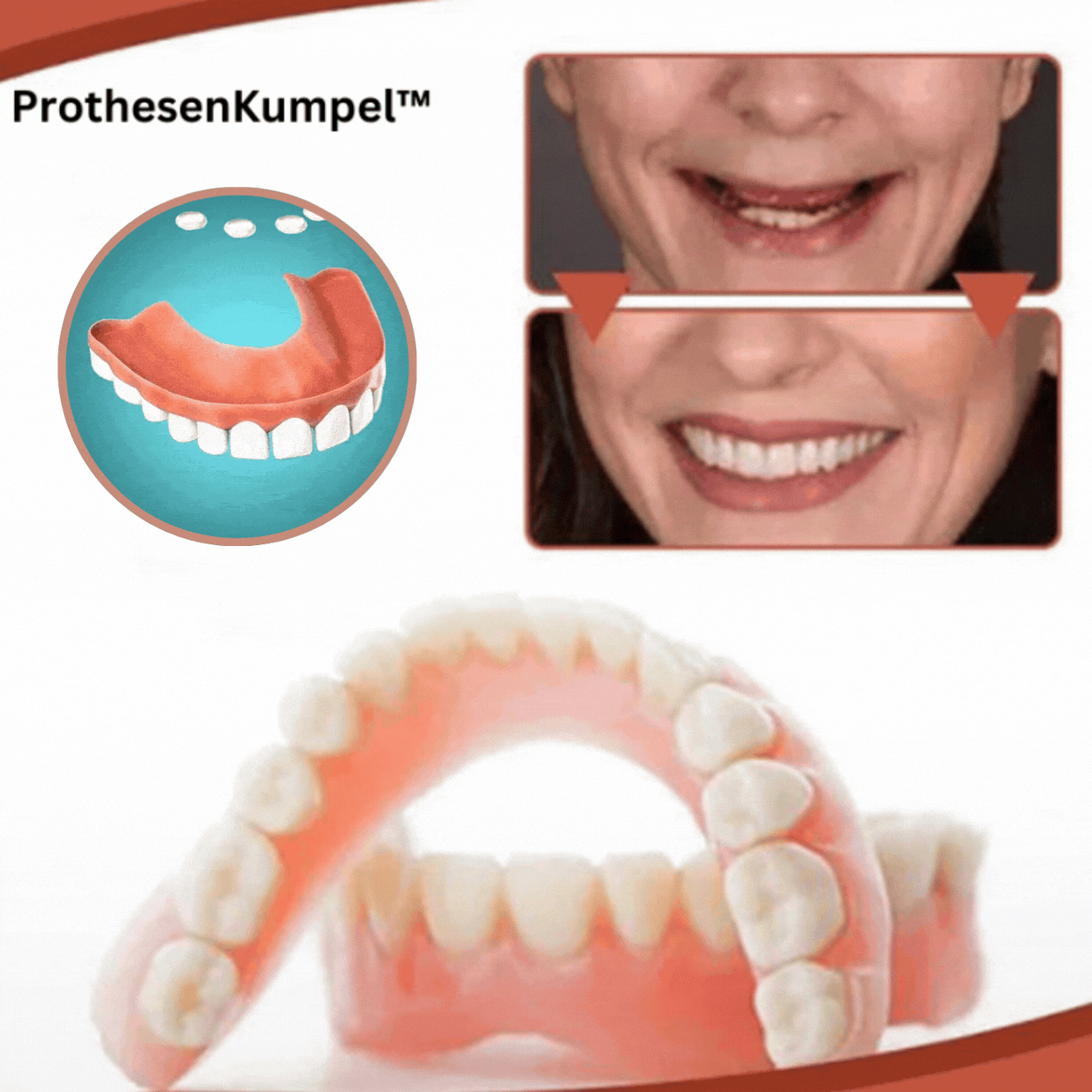 Upper and lower dentures with pink gum-coloured bases and white teeth