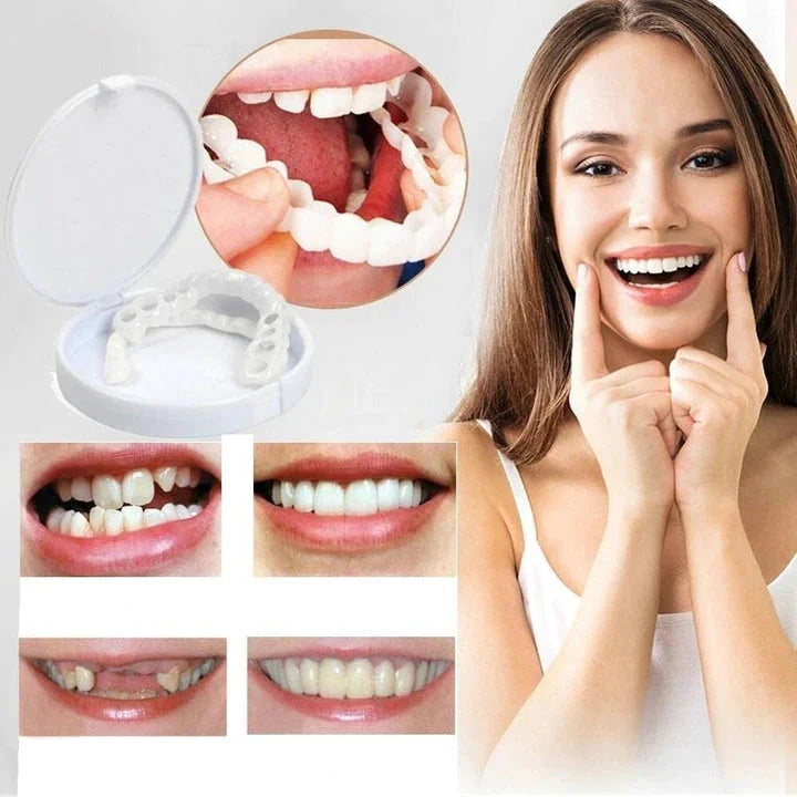 White snap-on dental veneers for upper and lower teeth with storage case