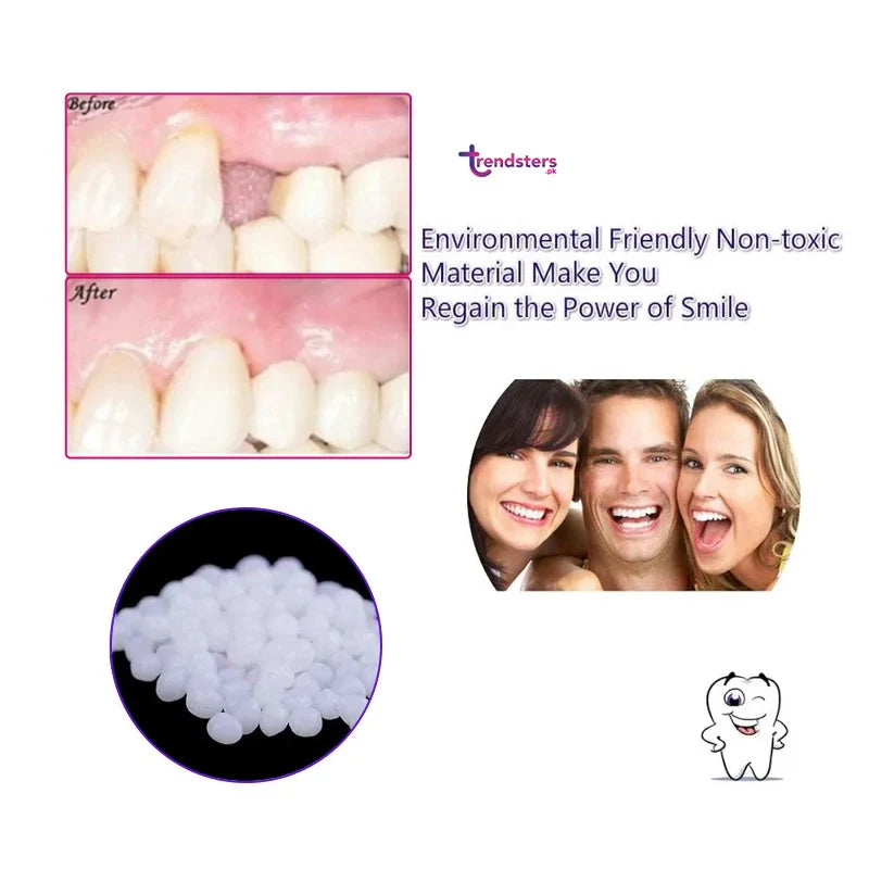 Mouldable false teeth kit with white tooth veneer, bottle and blue carton