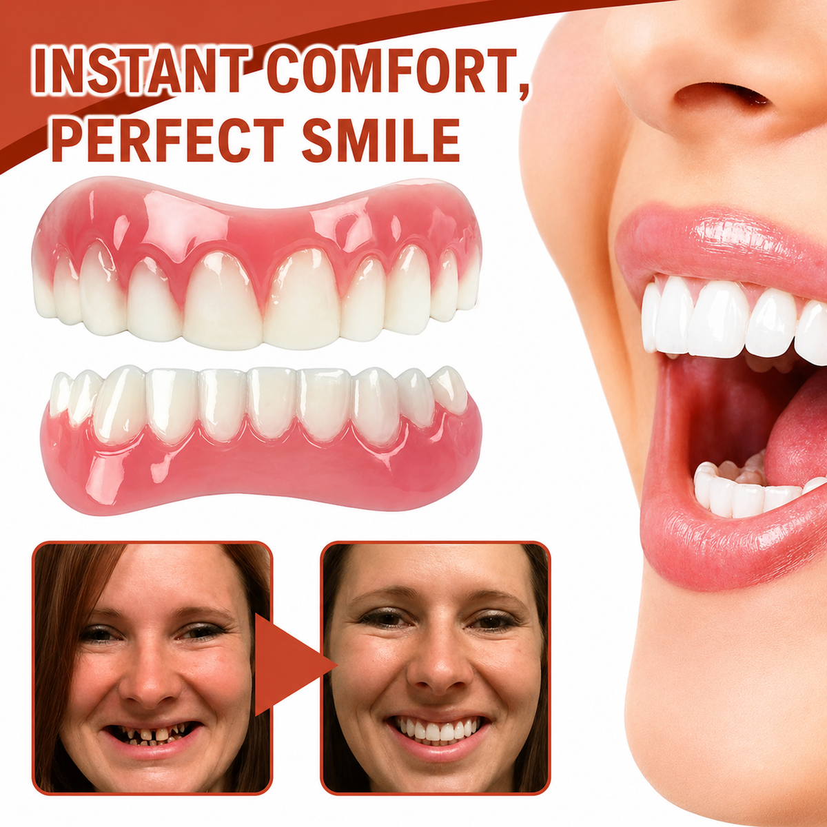 Upper and lower pink gum-effect cosmetic teeth covers with white teeth