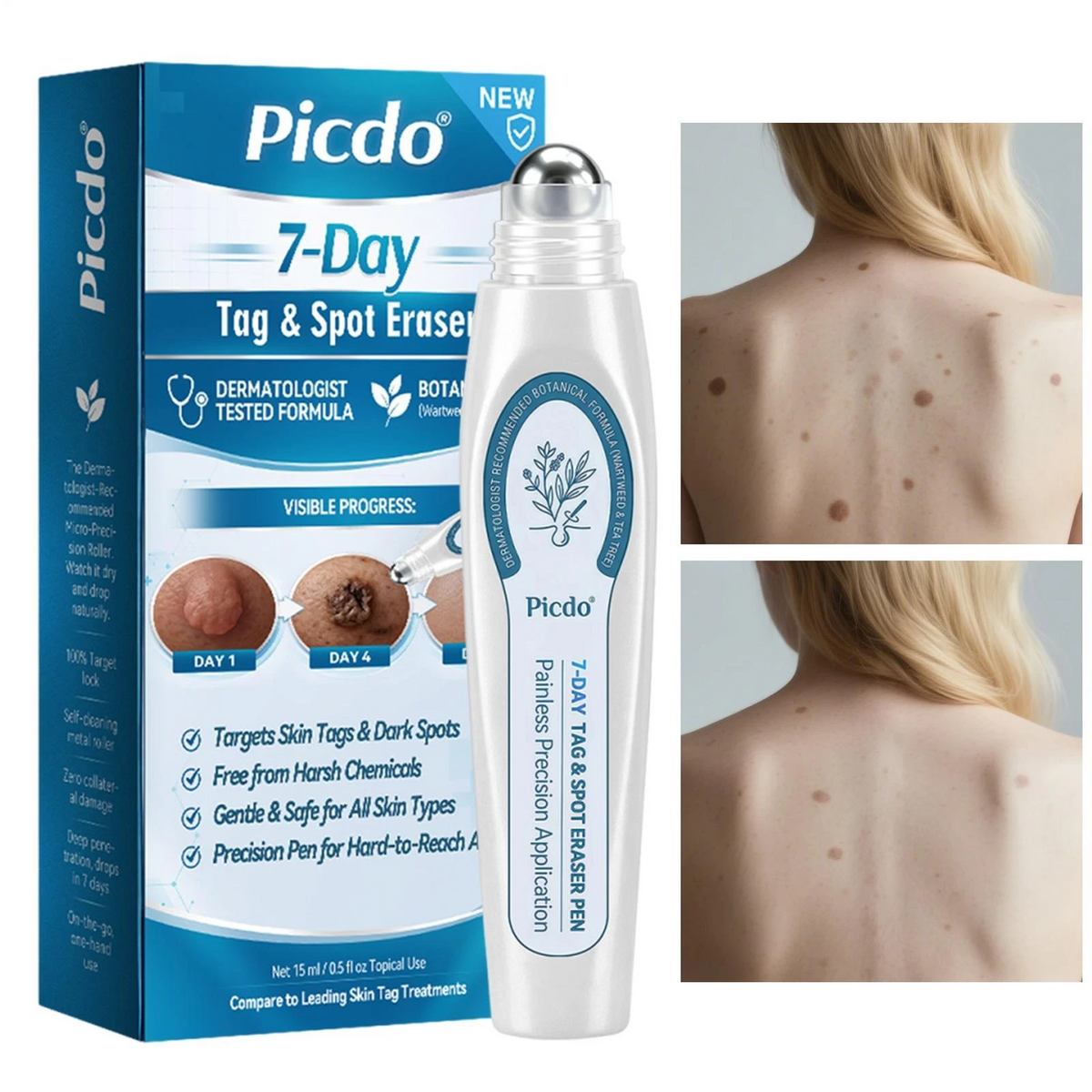 White skincare spot treatment pen with metal roller ball and printed box